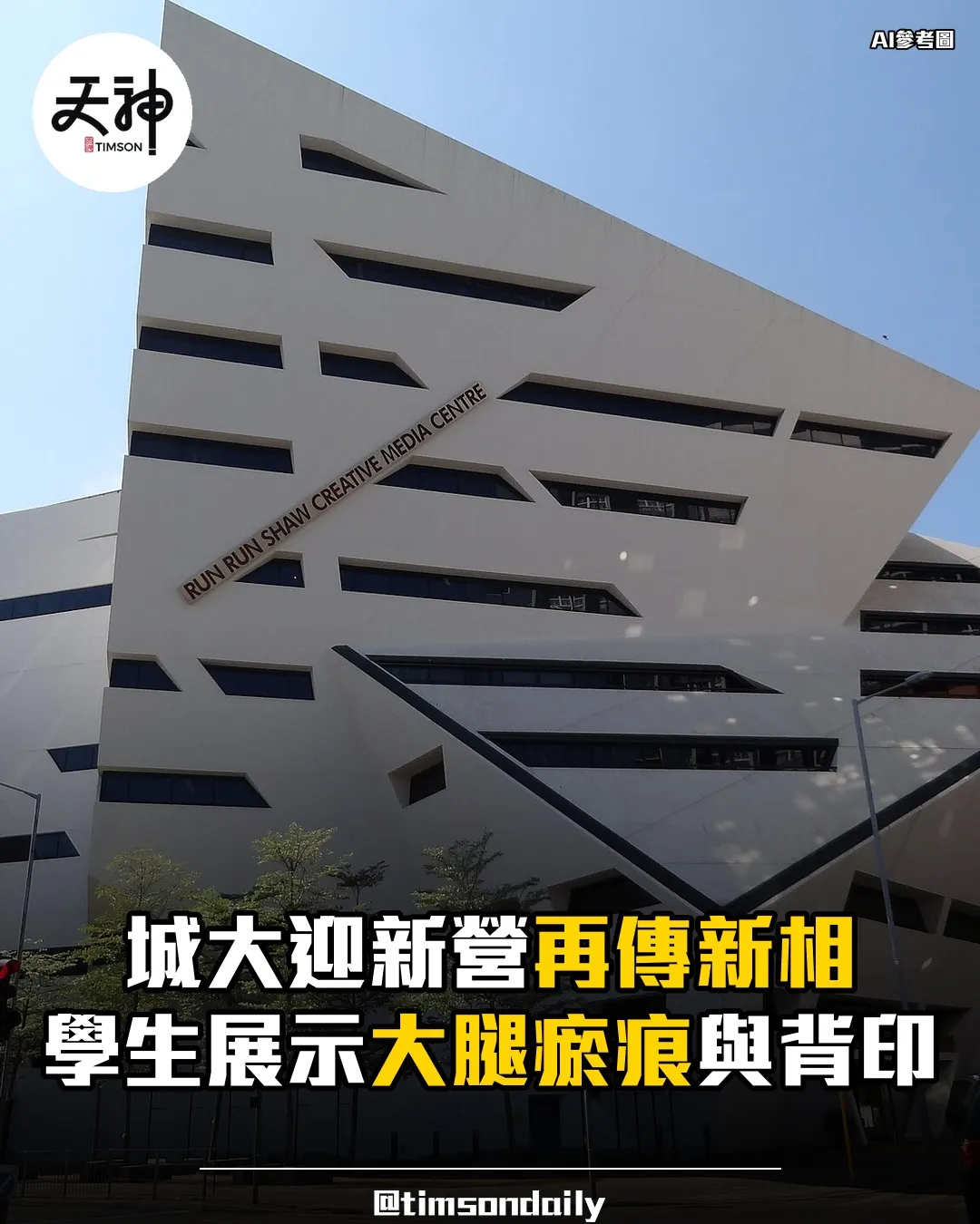 城大迎新營再傳新相 學生展示大腿瘀痕與背部紅印